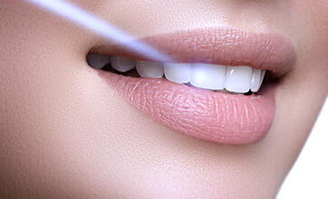 Лазерное отбеливание Doctor Smile и профессиональная гигиена полости рта со скидкой 20%
