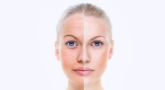 Биоревитализация улучшает состояние кожи
