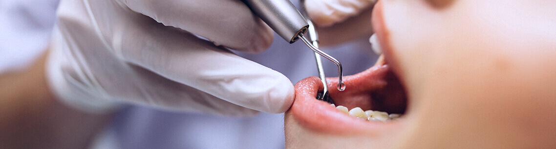 Диагностика острой зубной боли